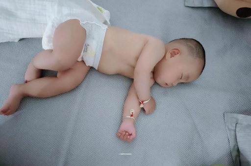 黑河宝宝头上长痱子